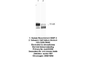 Image no. 1 for anti-Matrix Metalloproteinase 2 (MMP2) antibody (ABIN363213) (MMP2 Antikörper)