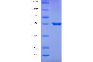 SDS-PAGE (SDS) image for Cytosolic Thiouridylase Subunit 2 (CTU2) (AA 20-196) protein (His-SUMO Tag) (ABIN5711143) (CTU2 Protein (AA 20-196) (His-SUMO Tag))