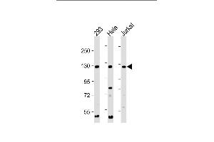 All lanes : Anti-INTS3 Antibody (C-Term) at 1:2000 dilution Lane 1: 293 whole cell lysate Lane 2: Hela whole cell lysate Lane 3: Jurkat whole cell lysate Lysates/proteins at 20 μg per lane. (INTS3 Antikörper  (AA 1000-1034))