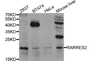 Western blot analysis of extracts of various cell lines, using RARRES2 antibody. (Chemerin Antikörper)
