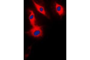 Immunofluorescent analysis of ACRBP staining in HeLa cells. (ACRBP Antikörper  (Center))
