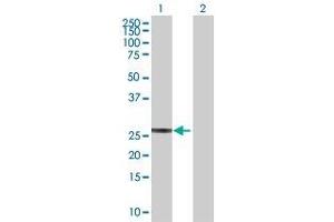Western Blotting (WB) image for F12 293T Cell Transient Overexpression Lysate(Denatured) (ABIN1331763)