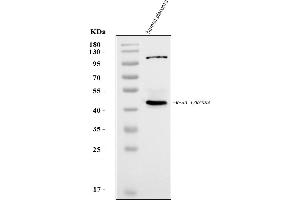 Western blot analysis of KCNN4 using anti-KCNN4 antibody (ABIN7599358).
