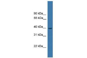 WB Suggested Anti-LTB4R Antibody Titration:  0.
