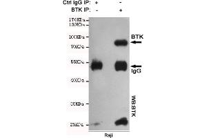 Immunoprecipitation analysis of Raji cell lysates using BTK mouse mAb. (BTK Antikörper)