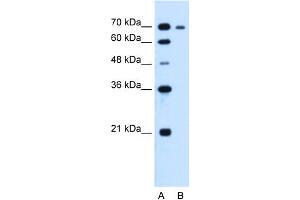 WB Suggested Anti-RRM1 Antibody Titration:  1. (RRM1 Antikörper  (N-Term))