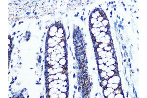 Immunohistochemistry of paraffin-embedded human colon using UQCRC2 Rabbit mAb (ABIN1679334, ABIN3018863, ABIN3018864 and ABIN7101676) at dilution of 1:100 (40x lens). (UQCRC2 Antikörper)