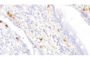 Immunohistochemistry (IHC) image for anti-Tryptase alpha/beta 1 (TPSAB1) (AA 151-275) antibody (ABIN7433102)