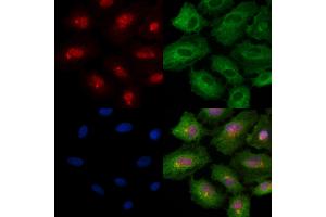 Phospho-Rab8 (Thr72) Antibody staining A549 cells(4h of LPS treatment) by IF/ICC.