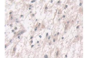 Immunohistochemistry (IHC) image for anti-Fucosyltransferase 6 (Alpha (1,3) Fucosyltransferase) (FUT6) (AA 35-359) antibody (ABIN7435952)