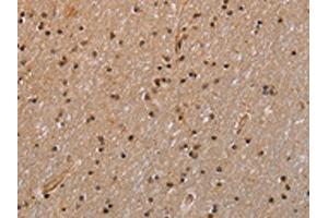 The image is immunohistochemistry of paraffin-embedded Human brain tissue using ABIN7129566(GADD45A Antibody) at dilution 1/30. (GADD45A Antikörper)