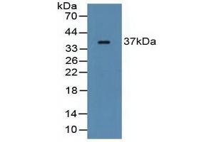 Figure. (FCN1 Antikörper  (AA 25-279))