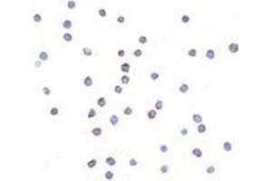 Immunocytochemistry of TLR6 in Jurkat cells with this product at 2 μg/ml. (TLR6 Antikörper  (Center))