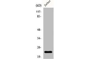 Western Blot analysis of Jurkat cells using D54 Polyclonal Antibody