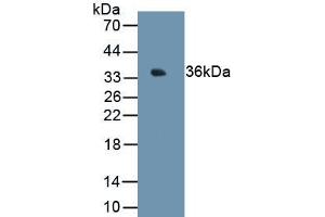 Detection of Recombinant MT1E, Human using Monoclonal Antibody to Metallothionein 1E (MT1E) (MT1E Antikörper  (AA 1-61))