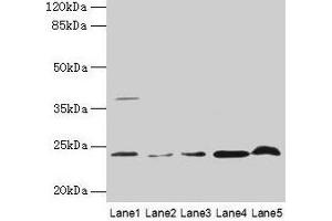 Western blot All lanes: CRYBA1 antibody at 6 μg/mL Lane 1: Human placenta tissue Lane 2: U251 whole cell lysate Lane 3: U937 whole cell lysate Lane 4: Mouse stomach tissue Lane 5: Mouse liver tissue Secondary Goat polyclonal to rabbit IgG at 1/10000 dilution Predicted band size: 26, 24 kDa Observed band size: 24 kDa (CRYBA1 Antikörper  (AA 1-215))