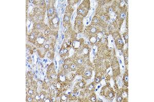 Immunohistochemistry (IHC) image for anti-Thiosulfate Sulfurtransferase (Rhodanese) (TST) (AA 1-297) antibody (ABIN6149660)