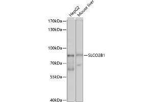 Western blot analysis of extracts of various cell lines, using SLCO2B1 antibody (ABIN6130909, ABIN6148066, ABIN6148067 and ABIN6214197) at 1:1000 dilution.