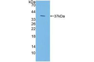 Western blot analysis of recombinant Human IDUa. (IDUA Antikörper  (AA 28-306))