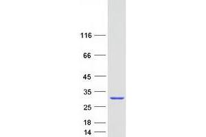Western Blotting (WB) image for RAB43, Member RAS Oncogene Family (RAB43) protein (Myc-DYKDDDDK Tag) (ABIN2730357)