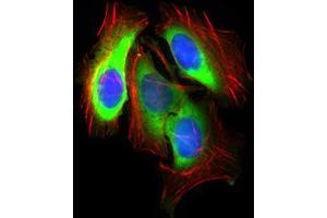 Immunocytochemistry (ICC) image for anti-Solute Carrier Family 2 (Facilitated Glucose Transporter), Member 4 (SLC2A4) (AA 224-353) antibody (ABIN1846354)