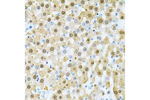 Immunohistochemistry of paraffin-embedded rat liver using PIBF1 Antibody. (PIBF1 Antikörper)