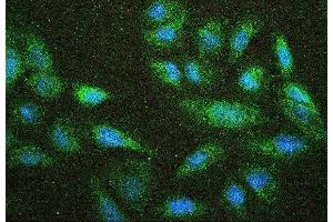 IF analysis of NF2 using anti-NF2 antibody (ABIN7600115) NF2 was detected in immunocytochemical section of U20S cell. (Merlin Antikörper  (AA 15-565))