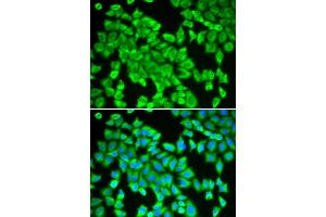 Immunofluorescence analysis of HeLa cells using STIP1 antibody (ABIN5970561). (STIP1 Antikörper)