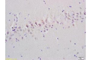 Formalin-fixed and paraffin embedded rat brain tissue labeled with Anti-Emp1/MUC1 Polyclonal Antibody, Unconjugated at 1:200, followed by conjugation to the secondary antibody and DAB staining (EMP1 Antikörper  (AA 101-160))