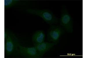 Immunofluorescence of monoclonal antibody to ZEB1 on U-2 OS cell. (ZEB1 Antikörper  (AA 801-900))