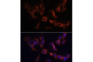 Immunofluorescence (IF) image for anti-ADP-Ribosylation Factor-Like 13B (ARL13B) (AA 1-240) antibody (ABIN6137109)