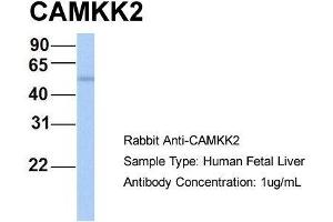 Host: Rabbit  Target Name: CAMKK2  Sample Tissue: Human Fetal Liver  Antibody Dilution: 1. (CAMKK2 Antikörper  (N-Term))
