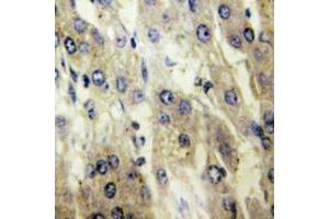 Immunohistochemical analysis of FATP5 staining in human liver formalin fixed paraffin embedded tissue section. (SLC27A5 Antikörper  (Center))