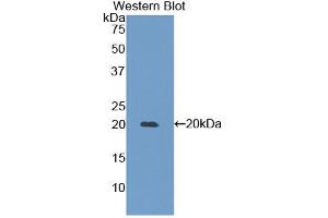 Western blot analysis of the recombinant protein. (MMP 9 Antikörper  (AA 225-390))
