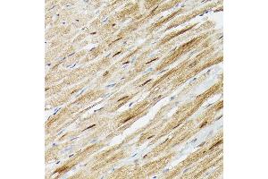 Immunohistochemistry (IHC) image for anti-Proteasome Subunit Alpha Type 3 (PSMA3) (AA 1-255) antibody (ABIN3021835)