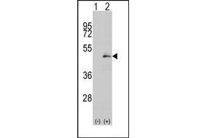 Image no. 1 for anti-Mitogen-Activated Protein Kinase Kinase 1 (MAP2K1) (Ser216) antibody (ABIN360367) (MEK1 Antikörper  (Ser216))