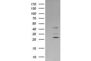 Western Blotting (WB) image for anti-Plasminogen Activator Inhibitor 2 (SERPINB2) antibody (ABIN1500885) (SERPINB2 Antikörper)