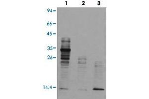 Western blot analysis of Lane 1: mouse brain tissue lysates, Lane 2: Hela cell lysates, Lane 3: TSA treated Hela cell lysates reacted with Acetyl lysine monoclonal antibody  at 1:1000-1:2000 dilution. (Acetylated Lysine Antikörper  (acetylated))