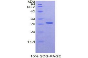 SDS-PAGE (SDS) image for Receptor-Interacting serine-threonine Kinase 3 (RIPK3) (AA 50-272) protein (His tag) (ABIN1878520)