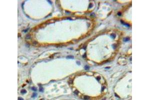 Used in DAB staining on fromalin fixed paraffin-embedded Kidney tissue (CA12 Antikörper  (AA 25-302))