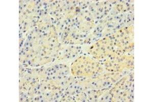 Immunohistochemistry of paraffin-embedded human pancreatic tissue using ABIN7170187 at dilution of 1:100 (SLC25A35 Antikörper  (AA 120-168))