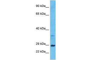 Host:  Rabbit  Target Name:  BDNF  Sample Type:  ACHN Whole Cell lysates  Antibody Dilution:  1ug/ml (BDNF Antikörper  (Middle Region))