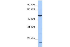 Human Lung; WB Suggested Anti-ZNF764 Antibody Titration: 0. (ZNF764 Antikörper)