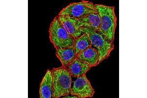 Immunocytochemistry (ICC) image for anti-CPV-VP2 (AA 1-128) antibody (ABIN5869165) (CPV-VP2 (AA 1-128) Antikörper)