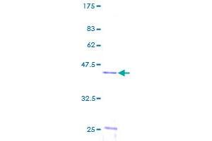 Image no. 1 for Ubiquitin-Conjugating Enzyme E2N (UBE2N) (AA 1-152) protein (GST tag) (ABIN1324390) (UBE2N Protein (AA 1-152) (GST tag))