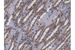DAB staining on IHC-P; Samples: Mouse Kidney Tissue (Ninein Antikörper  (AA 1-153))