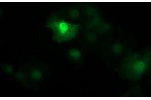 Image no. 2 for anti-Catenin (Cadherin-Associated Protein), beta 1, 88kDa (CTNNB1) antibody (ABIN1496898) (CTNNB1 Antikörper)