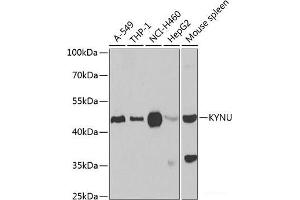 Western blot analysis of extracts of various cell lines using KYNU Polyclonal Antibody at dilution of 1:1000. (KYNU Antikörper)