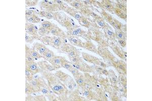 Immunohistochemistry of paraffin-embedded human liver using UCHL3 antibody. (UCHL3 Antikörper  (AA 1-220))