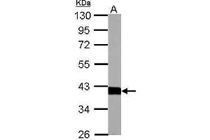 Western Blotting (WB) image for anti-Aldolase B, Fructose-Bisphosphate (ALDOB) antibody (ABIN2855024)